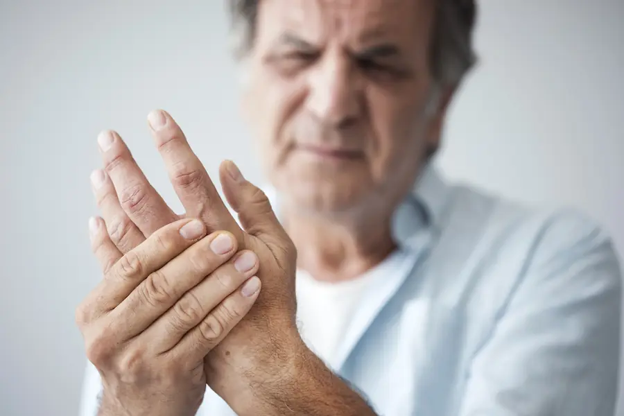 Rheumatoid Arthritis representation
