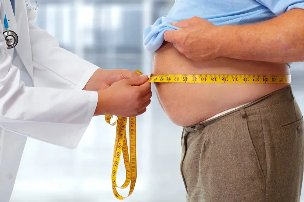 Obesity representation