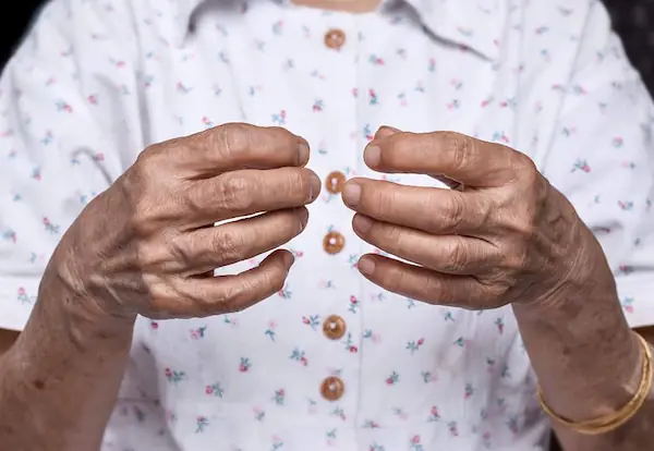 Rheumatism representation